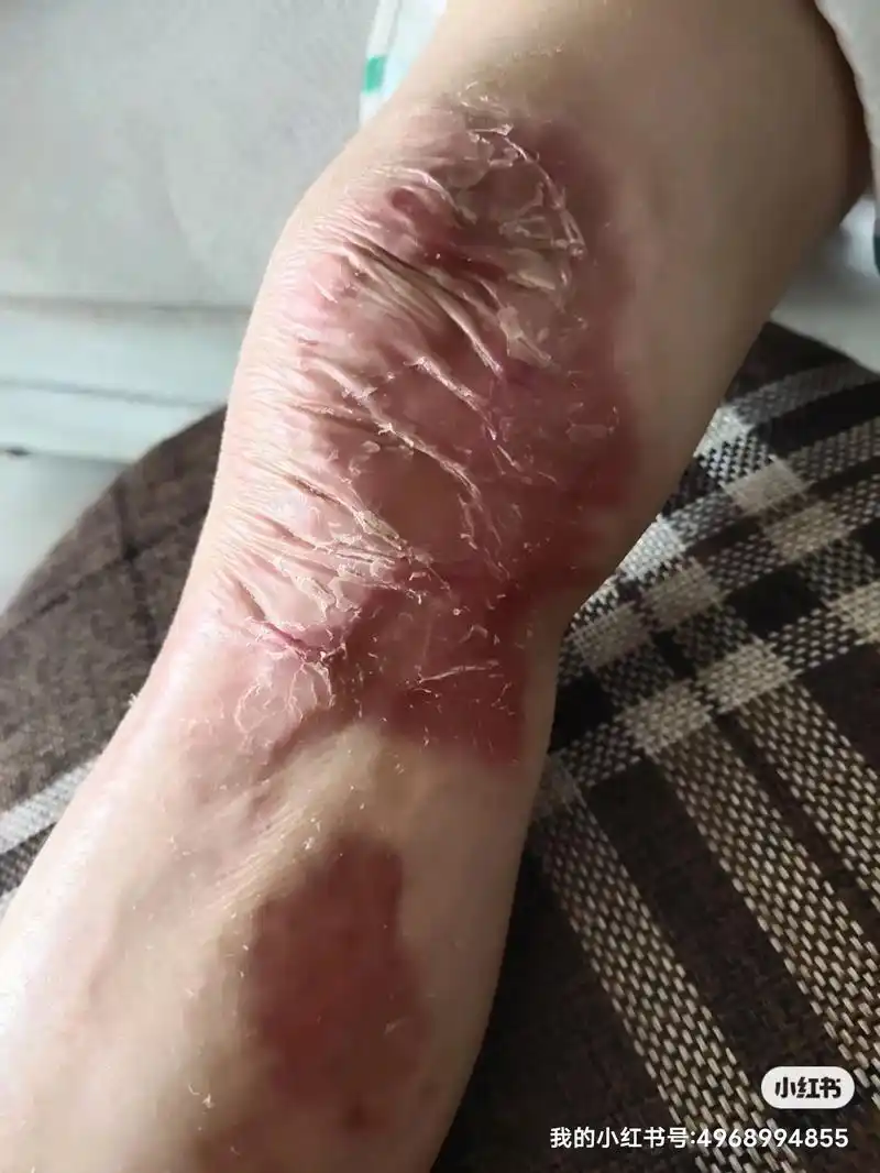 拥有国家专利烧烫伤新老疤痕,生发技术,问题性皮肤专业修复. - 抖音