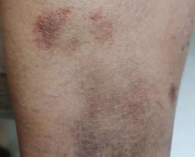 神经因素,精神因素,某些皮肤病或系统性疾病(如糖尿病,尿毒症,胆汁