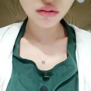 玻尿酸丰唇打造可爱嘟嘟唇