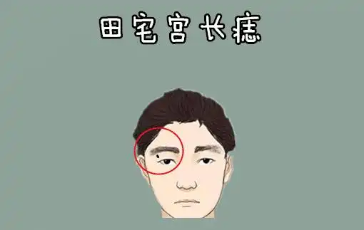 身体5颗横财痣,男人车房不愁,女人发财不愁,马上走大运!