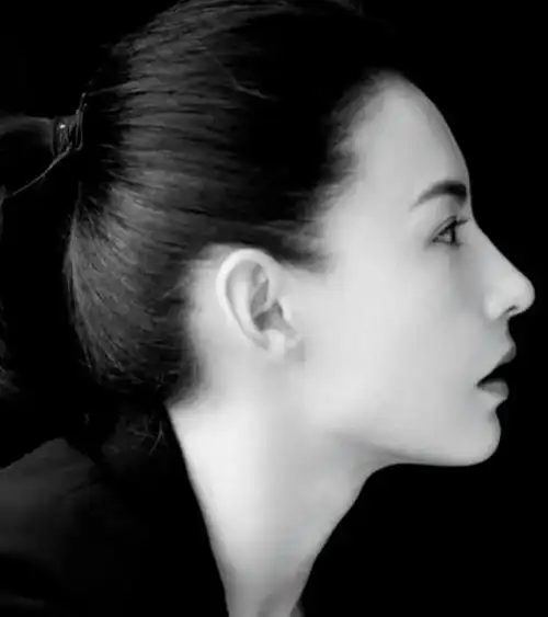 像刘亦菲的驼峰鼻,张柏芝的水滴鼻,这种原生鼻就不仅好看还形成鲜明