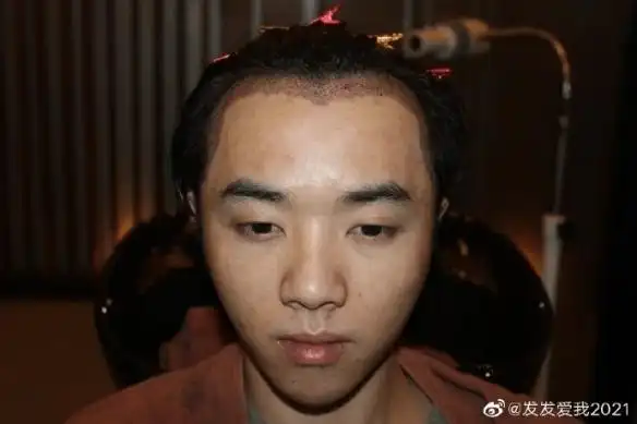 华晨宇前女友爆料华是整容脸怒骂张碧晨是小三