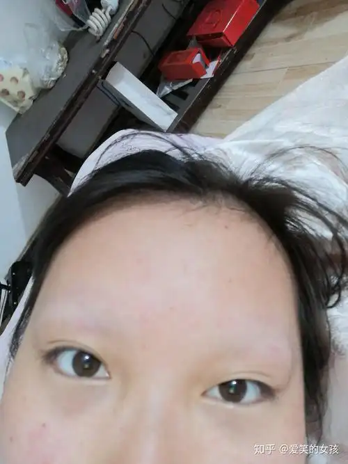 剃眉毛的第二天