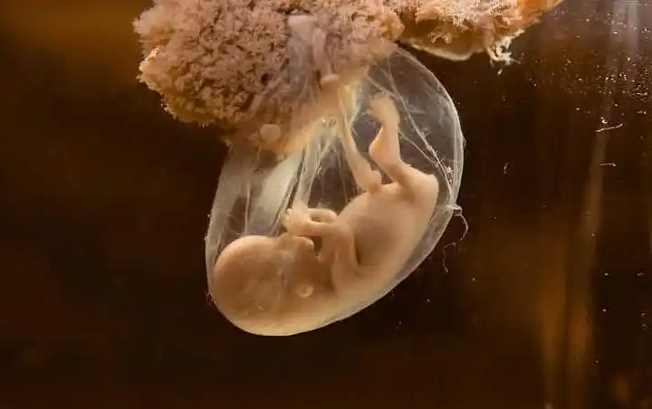 孕6个月,是胎儿脐带绕颈的"高发期",孕妇早知道早预防