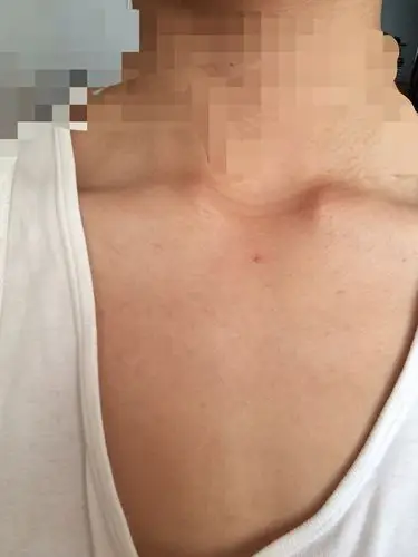 我这是不是发育不良啊