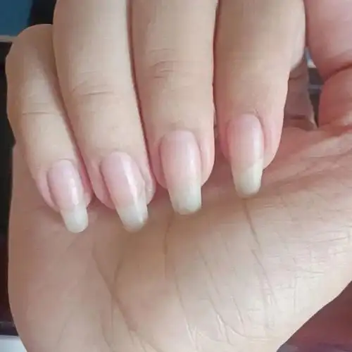 有指甲长这样的吗