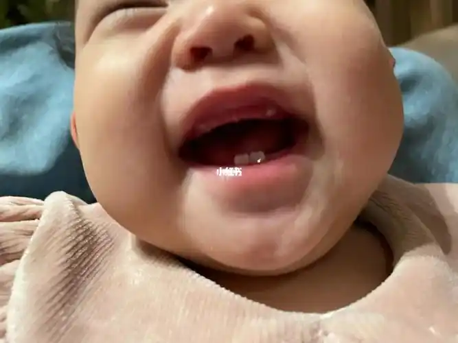 8个月宝宝长虎牙