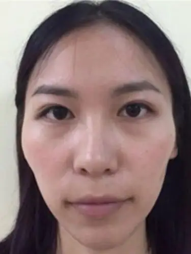 颧骨高该怎么修饰呢?