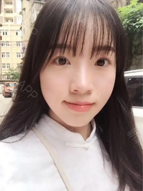 今天过生日朋友发了张过的照片,为什么普通人稍微整下_圈子-新氧美容