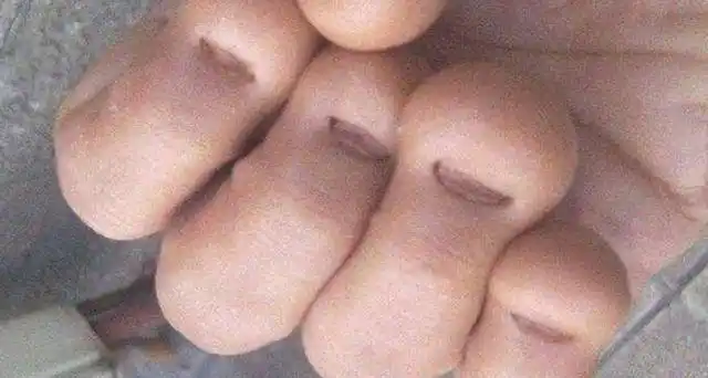 医生:多半难逃这2种结局|指甲|手指|结局_新浪新闻