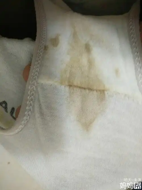 怀孕6 5白带这个颜色亲们帮我看看