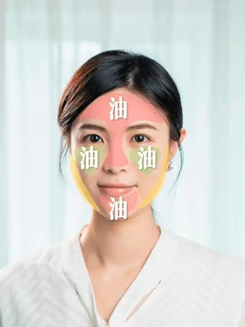 2—油皮:t区&下巴出油 脸颊出油干性皮肤最明显的特征是皮脂分泌的少
