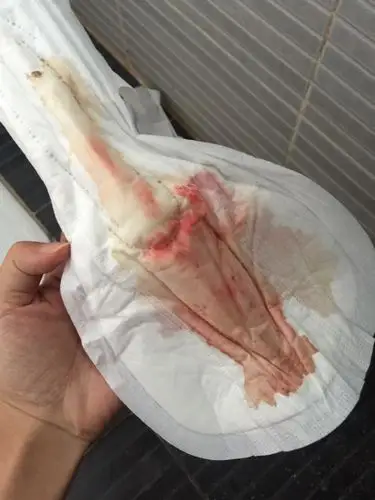 经期血怎么是淡红色的?