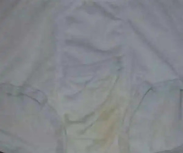 孕期变化很大若内裤变黄可能和这些原因有关