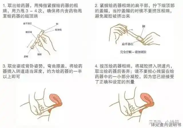 口服塞药打针3大黄体酮横向测评来了