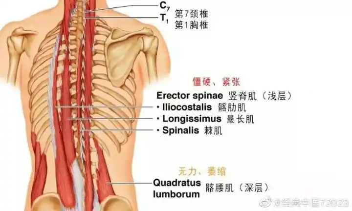 腰肌劳损到底是腰部的哪些肌肉劳损了?