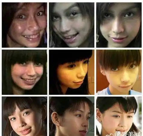 女星整容前后对比,有人美貌出众,有人惨不忍睹_柳岩_美女_赵丽颖