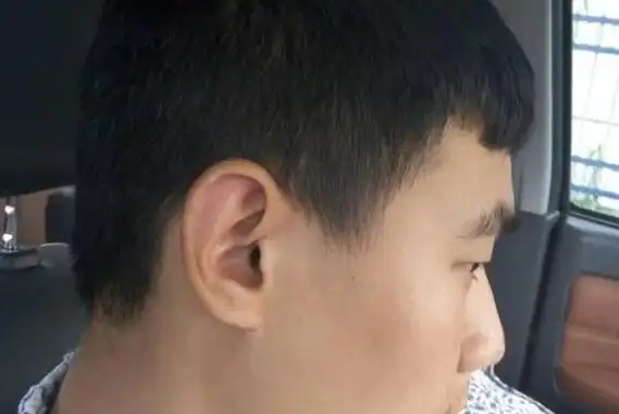 扁头面相好不好民间传说扁头人聪明实则会影响人的健康