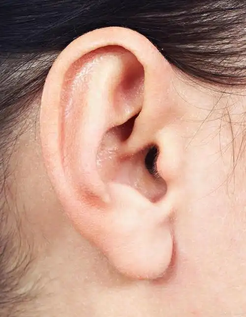 耳廓再造需要多少费用及相关因素解析