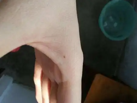 左手虎口有痣,右手虎口有痣,虎口有痣图解