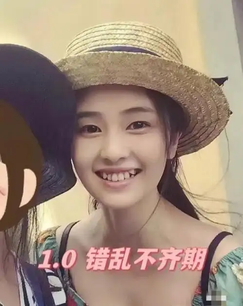 白鹿牙齿逐渐整齐的过程.白鹿长着小虎牙的时候还挺可爱的.