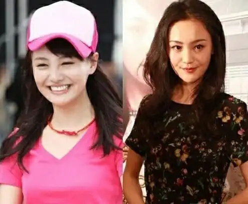 郑爽整容前后的对比,真的是变化好大