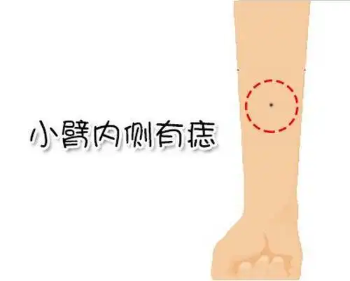 小臂内侧有痣:天生财运旺