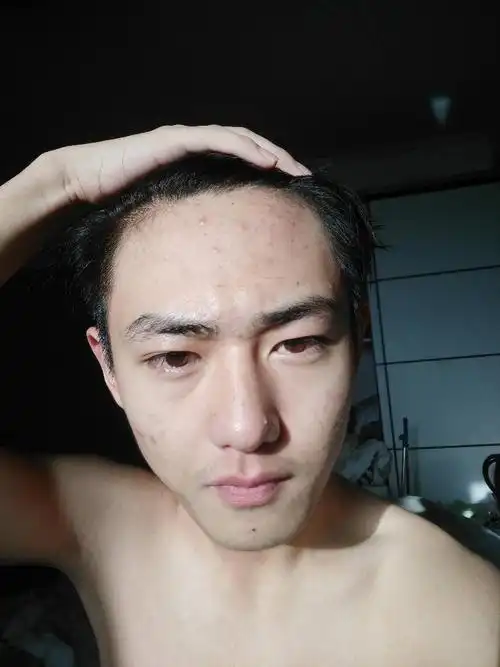 男人发际线高好吗