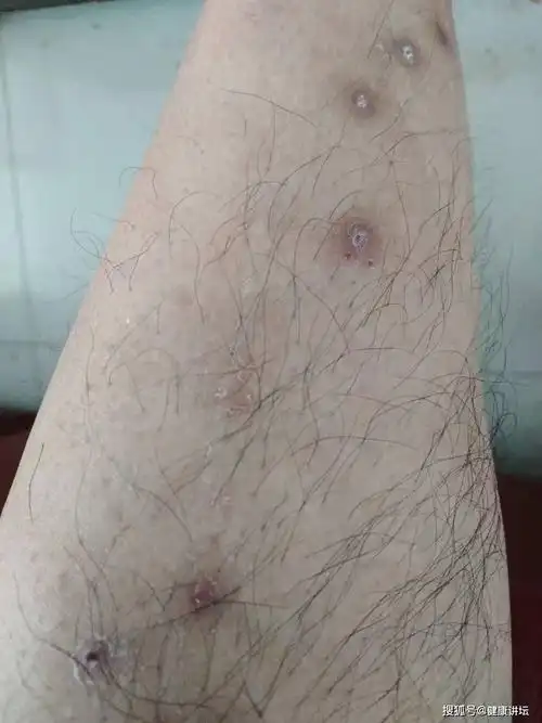 巧借酷暑好排毒星星论道