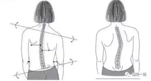 热巴身材跌下神坛骨盆前倾肋骨外翻肩胛骨突出程度超过周冬雨