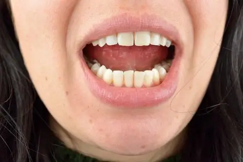 特写,健康,牙齿,年轻,牙齿保健,卫生,牙科