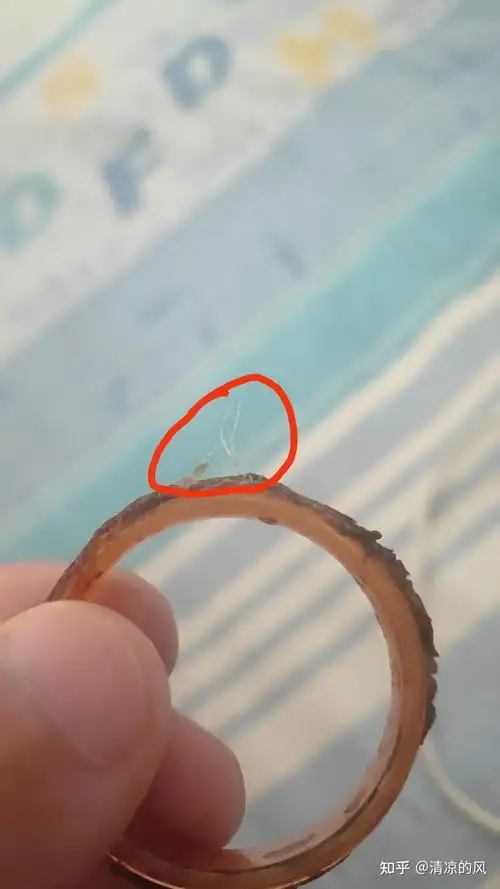 老是扯着太疼了,早晨我终于把内环去了,现在一切都好,只要等结痂脱落