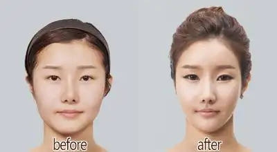 高鼻梁,低鼻梁有什么区别?