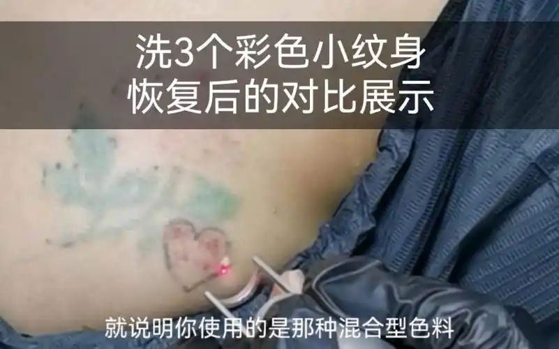 洗3个彩色小纹身,恢复后的对比展示.