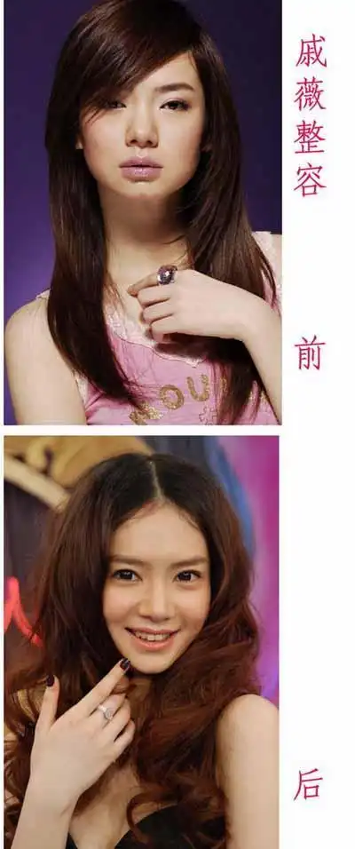 戚薇整容照片对比