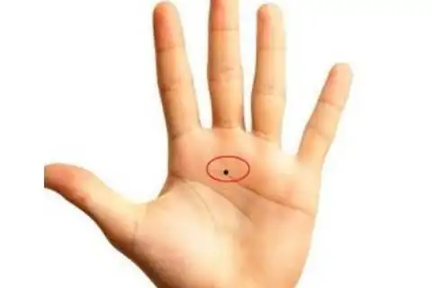 感情线上有痣好不好 代表了什么?