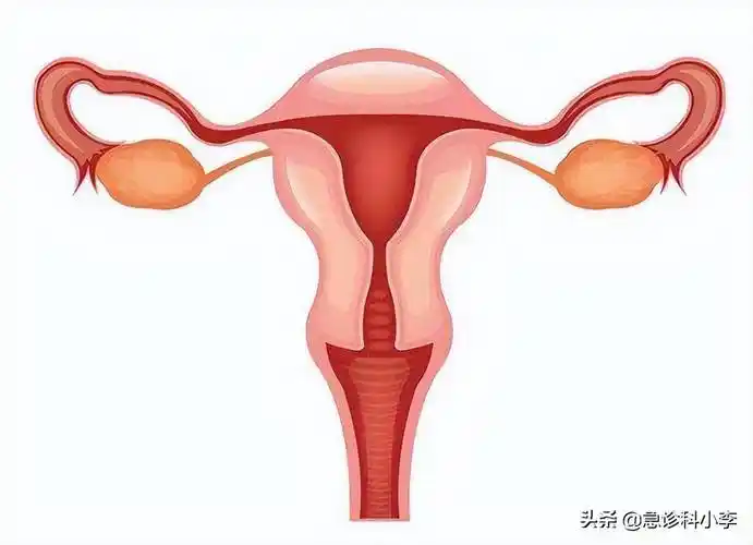 女性为什么容易长子宫肌瘤医生平时尽量避免3个行为别忽视