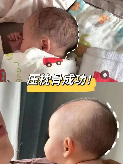 月子里为了防止嘻宝扁头,就让嘻宝每天变换左右方向侧