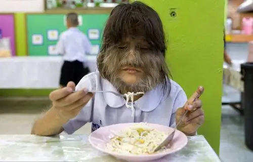 世界上仅存的"狼人"