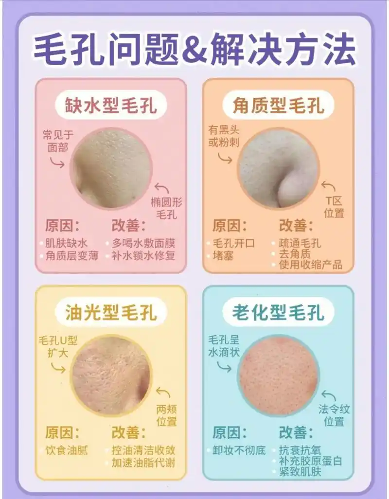 毛孔粗大怎么办?分清毛孔类型,正确护肤.#图文来了 #护肤  - 抖音