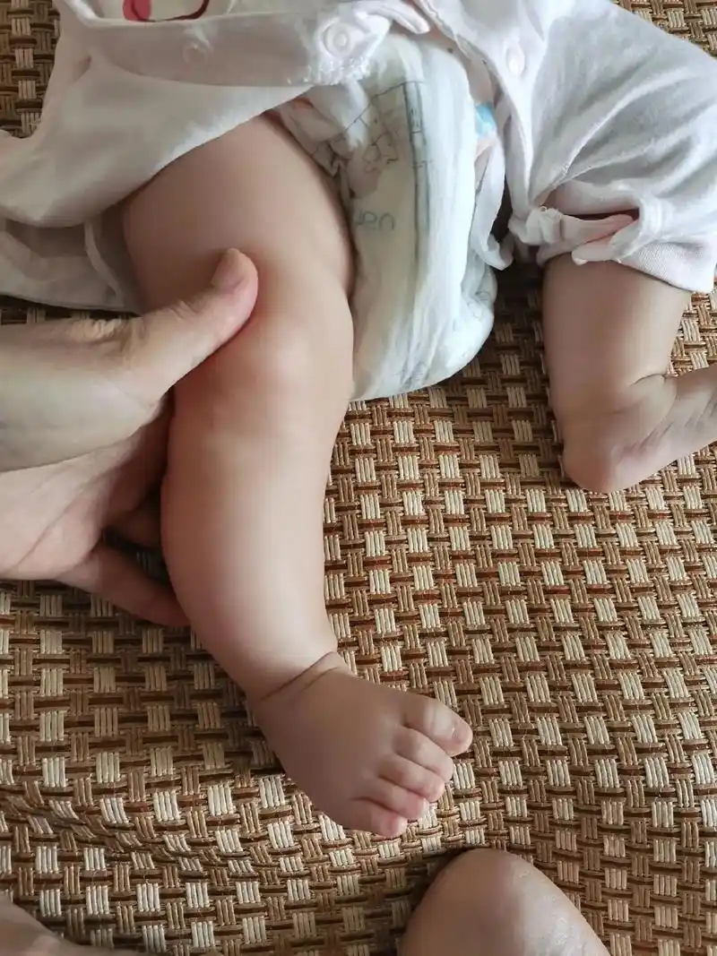 我又要焦虑了,三个月体检医生说她腿侧弯厉害