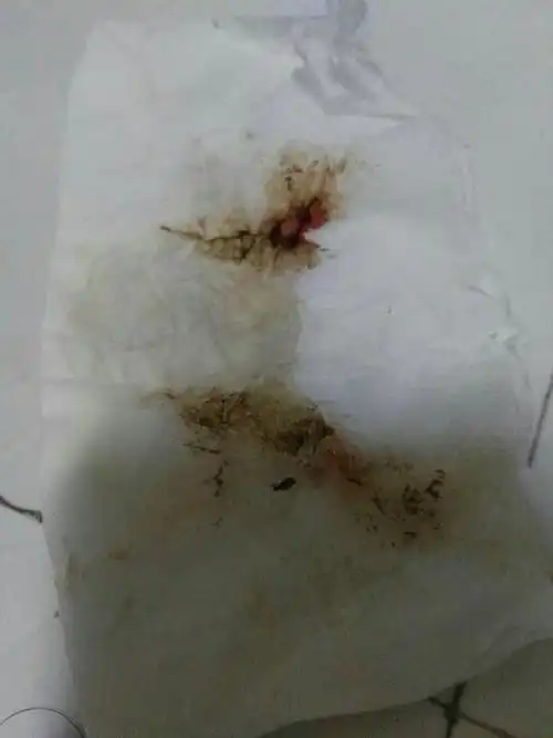 容易!月经呈褐色是怎么回事"口口声声"-第2张图片-蒲城博客