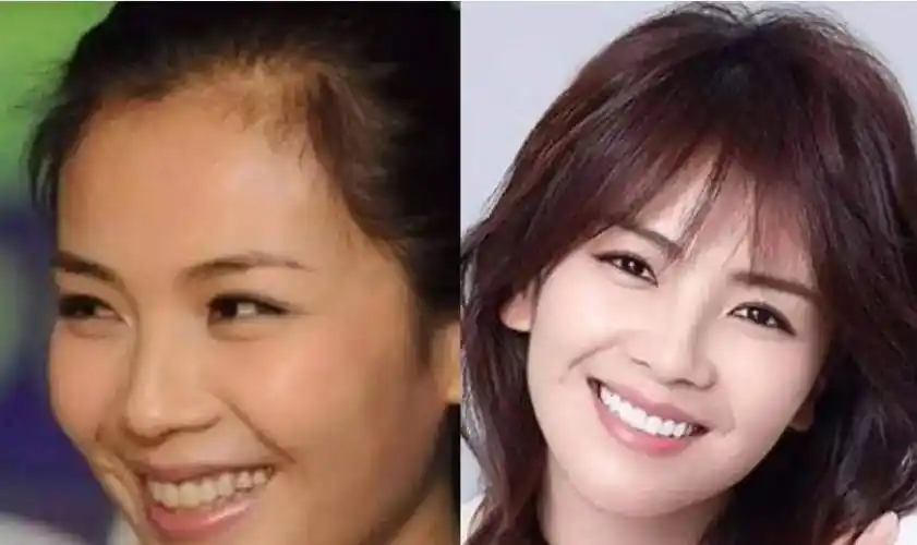 女明星"假牙"大pk,谁的嘴巴闭不上,谁的嘴里藏着一套房?