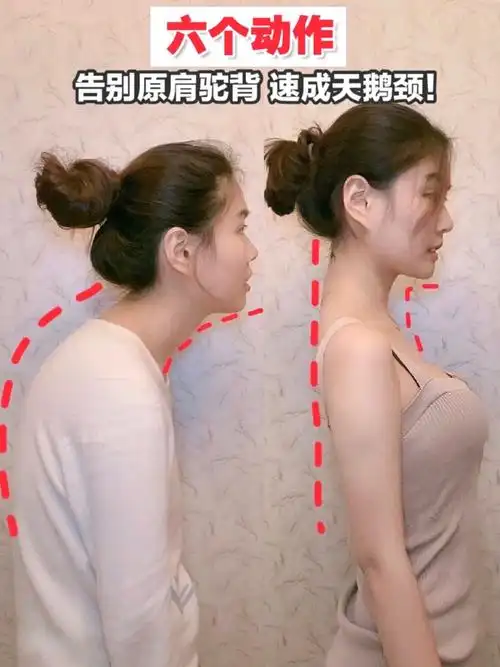 体态决定气质矫正圆肩驼背/改善斜方肌