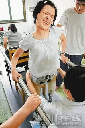 北川学生历尽艰辛9个月 用假肢走回学校(组图)