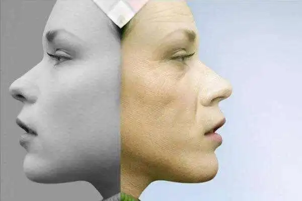 微整形的适用范围有哪些?存在风险吗?