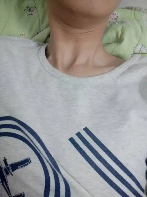 我18岁男生非常瘦,但脖子特别松弛