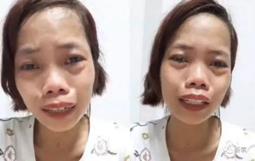 长得丑被骂到想自杀换头后逆袭成翻版高圆圆让所有人傻眼