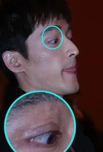 同样遭遇毁容胡歌成为正能量他却被喷