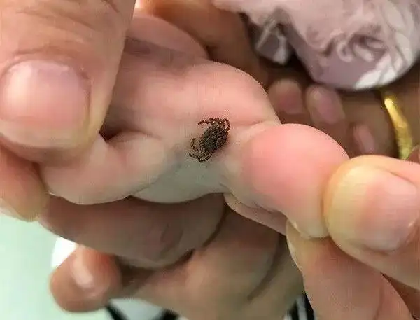 为拿赏金养致命虫?广州全城悬赏捉虫引全国关注,但更可怕的就在身边